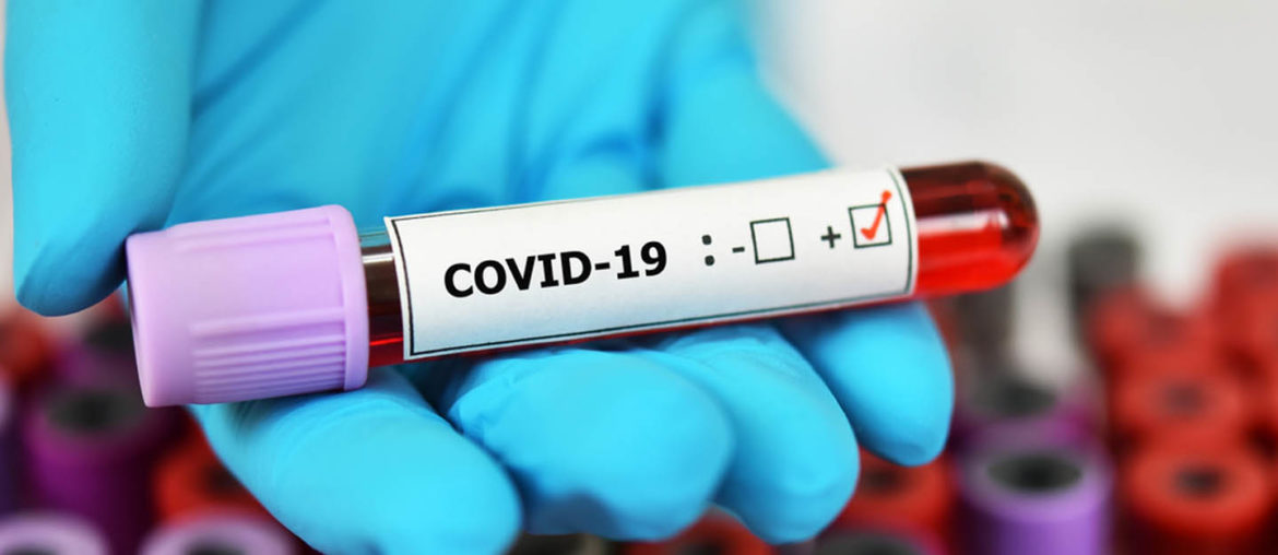 Where to Go for a COVID19 PCR Test in Ras Al Khaimah MyBayut