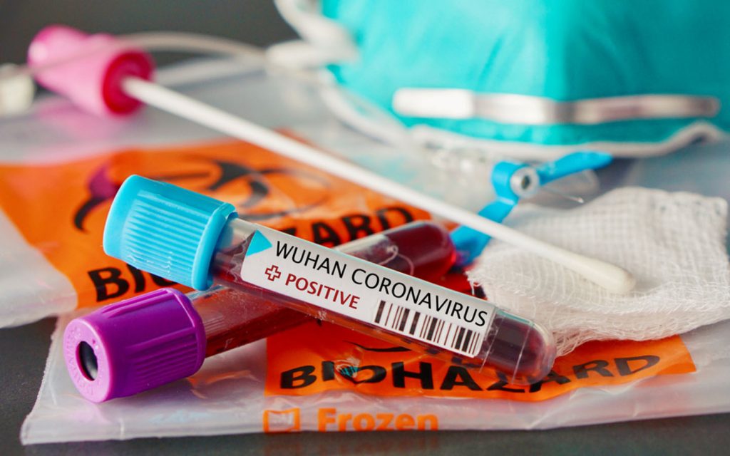 A blood sample in a tube, tested positive for coronavirus