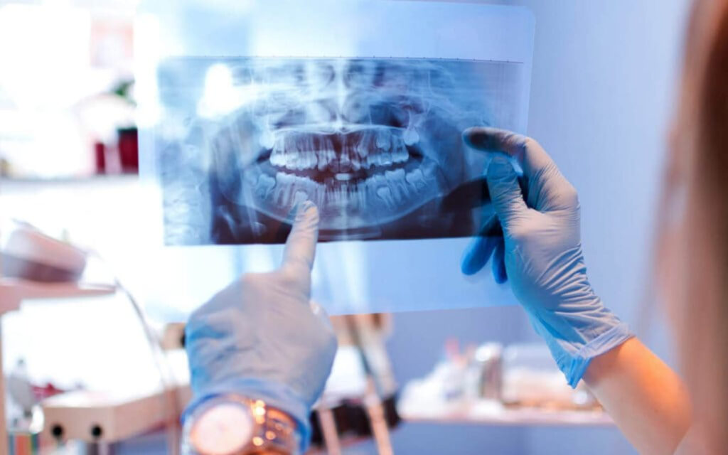 صورة أشعة للأسنان